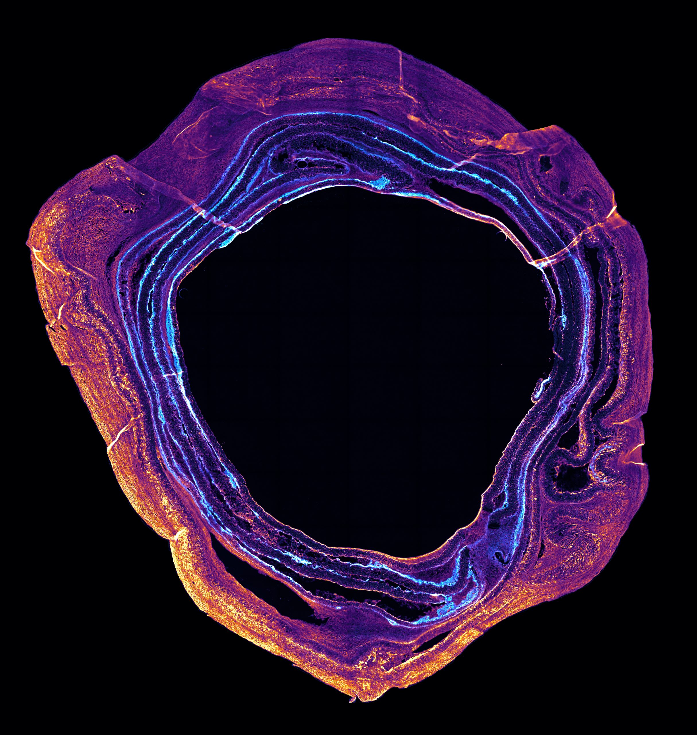 Microscope photo of lab grown intervertebral disc. Deep black background with concentric circles, transitioning in colour from cyan blue rings in the centre to magenta and finally to hot yellow on the outermost rings.