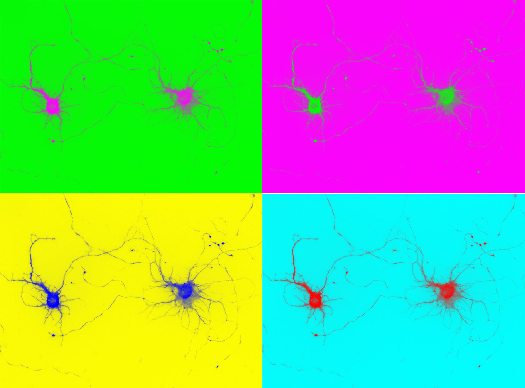 The image is a composite of 4 modification of the same image displaying 2 neurons making contact. Different background colours make a sharp contrast with the neurons that also have different bright colour.