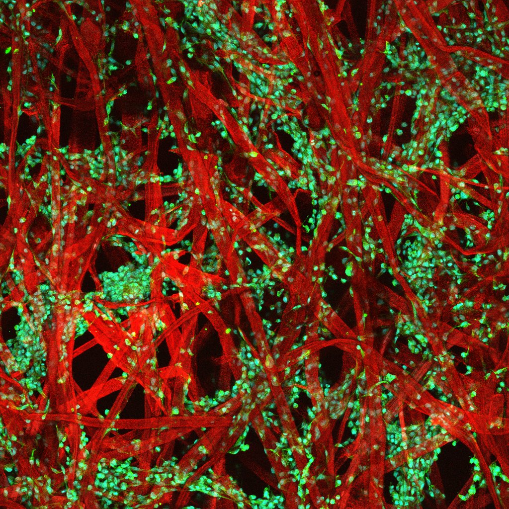 Green cells distributed in a tangle of red fibers