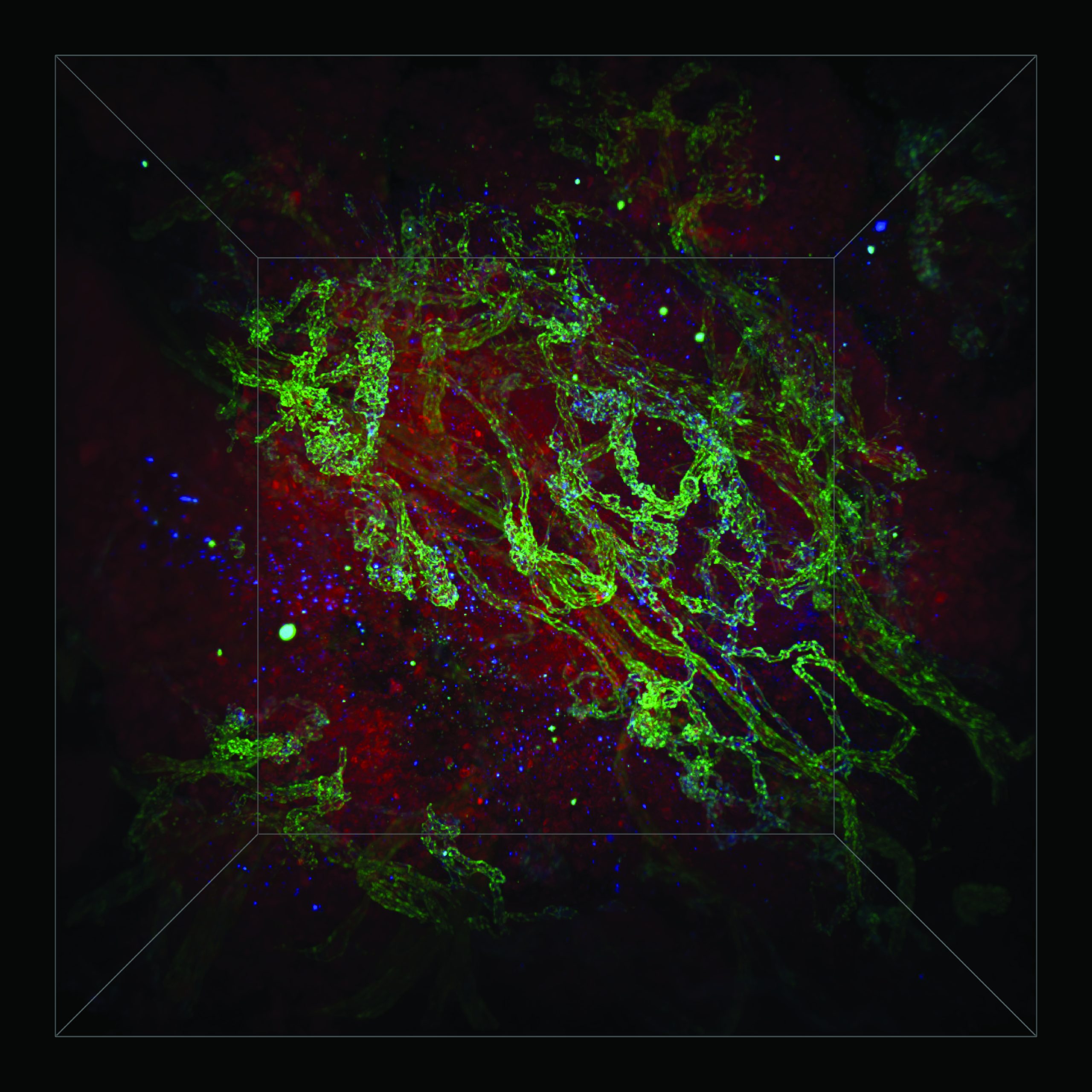 A photograph of bright green and blue streaks reveal blood vessels that are surrounded by a red clouds of tumour cells which form a cosmic landscape when viewing an ovarian tumour sample under a microscope.