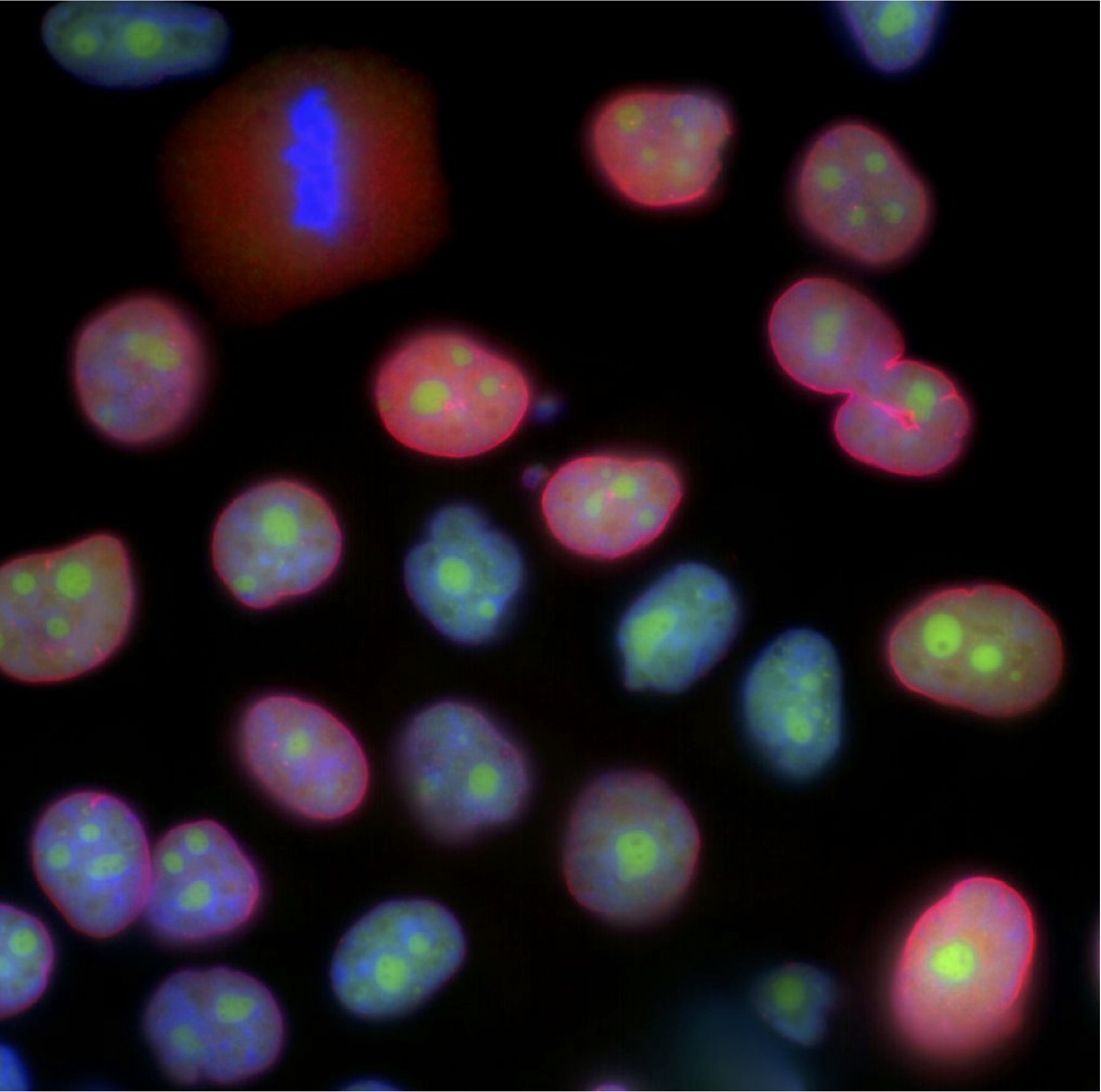 Microscope image of human cells stained with fluorescent markers for nuclear envelope proteins, DNA, and active gene transcription.