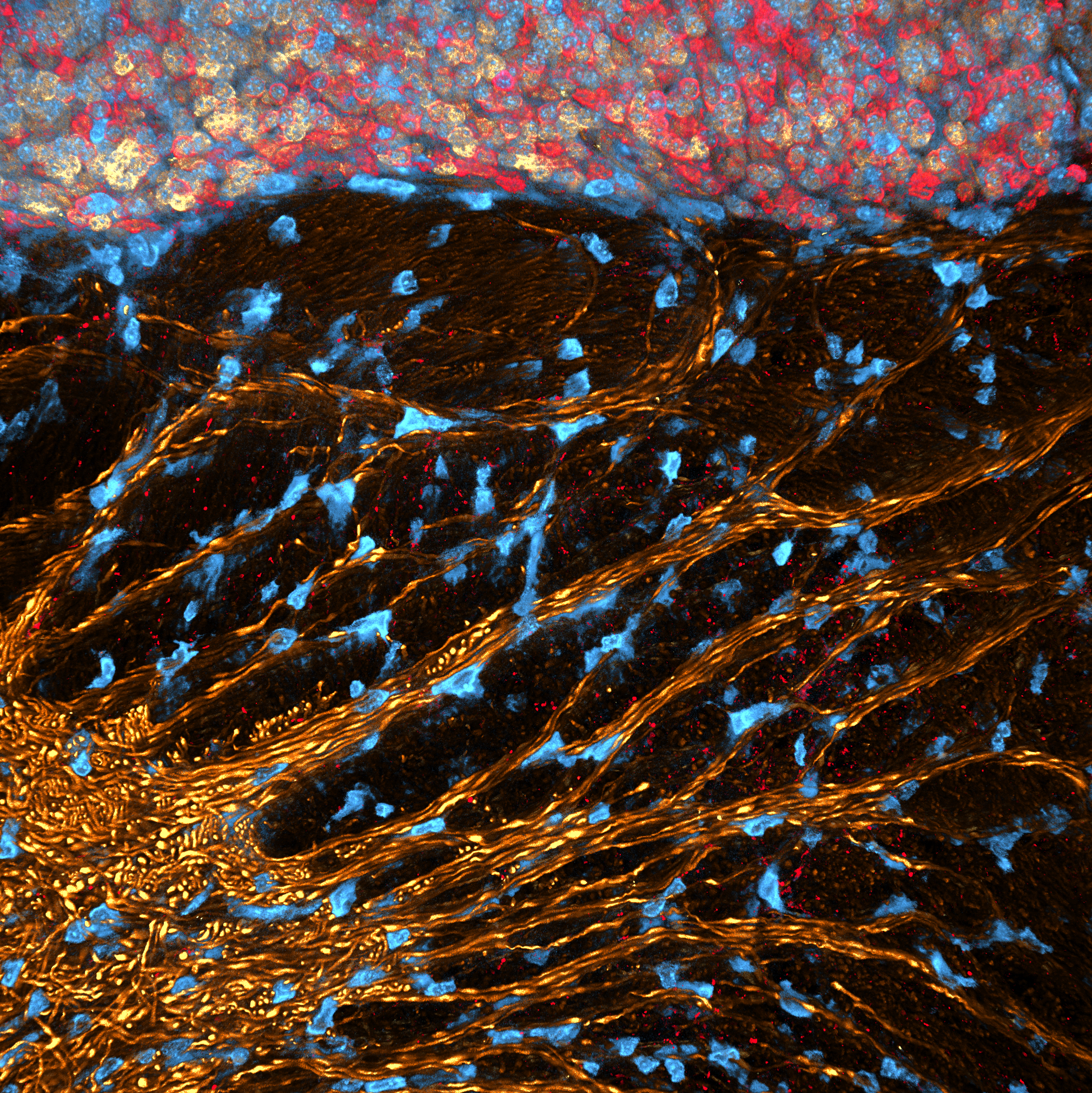 A golden sunlike circle of fibres reache out from the bottom left corner of the image. Image of the cerebellar cortex.